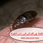 شركة مكافحة بق الفراش في راس الخيمة